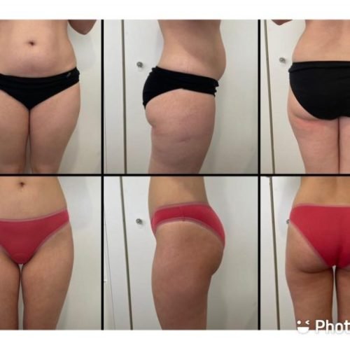 MED-CONTOUR-min-768x513